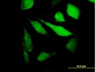 H00025824-B01P - Peroxiredoxin-5 / PRDX5