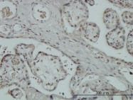 H00025850-M01 - ZNF345