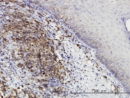 H00025865-M01 - PRKD2 / PKD2