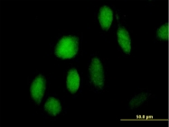H00025888-B01 - ZNF473