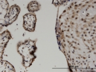 H00025937-M05 - WWTR1 / TAZ
