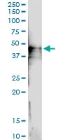 H00025945-D01 - CD113 / Nectin 3