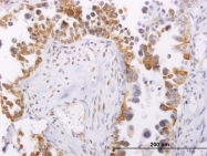 H00025984-M01 - Cytokeratin 23