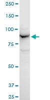 H00026060-A01 - APPL1 / DIP13A