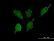 H00026061-B01P - HACL1 / PHYH2
