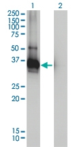 H00026119-M01 - LDLRAP1