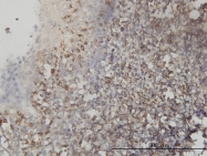 H00026136-M01 - Testin / TES
