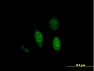 H00026469-B01P - PTPN18 / BDP1
