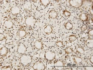 H00026508-M07 - HEYL / HRT3