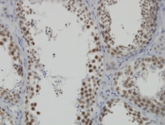 H00026512-M02 - INTS6 / DDX26