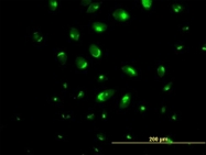 H00027032-B01P - ATP2C1