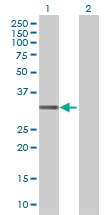 H00027120-B01 - Dickkopf-like protein 1