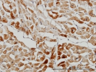 H00027129-M01 - HSPB7