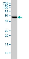 H00027175-M01 - TUBG2 / Tubulin gamma 2