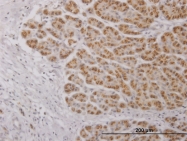H00027189-B01P - Interleukin-17C / IL17C