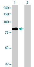 H00027242-B02 - TNFRSF21 / Death receptor 6 (DR6)