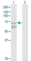 H00027242-D01P - TNFRSF21 / Death receptor 6 (DR6)