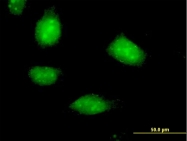 H00027244-B01P - Sestrin-1 (SESN1)