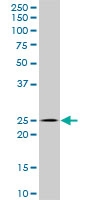 H00027289-A01 - RND1 / RHO6