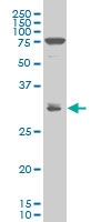 H00027289-A01 - RND1 / RHO6