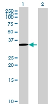H00027295-B02 - PDLIM3