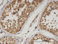 H00027329-M01 - Angiopoietin-5