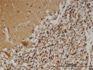 H00027344-M02 - PCSK1N
