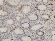 H00028951-M04 - TRIB2