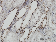 H00028960-M02 - DCPS