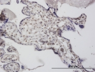 H00028960-M03 - DCPS
