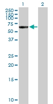 H00029119-D01P - Catenin alpha-3 / CTNNA3