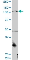 H00029119-D01P - Catenin alpha-3 / CTNNA3