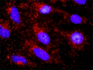 H00029119-D01P - Catenin alpha-3 / CTNNA3