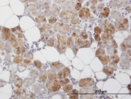 H00029121-M01 - CLEC2D