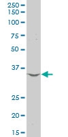 H00029126-A01 - CD274 / PDL1