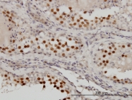 H00029127-M01 - RACGAP1