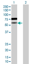 H00029760-D01P - B-cell linker protein / BLNK