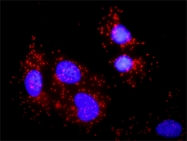 H00029760-M04 - B-cell linker protein / BLNK