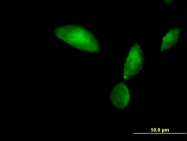 H00029766-B01P - Tropomodulin-3 (TMOD3)