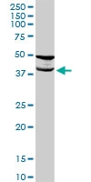 H00029767-D01 - Tropomodulin-2 (TMOD2)