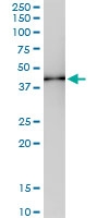 H00029767-D01 - Tropomodulin-2 (TMOD2)