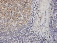 H00029802-B01 - VPREB3