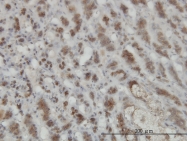 H00029925-M07 - GMPPB