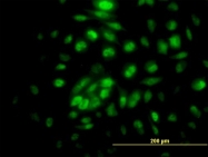 H00029935-B01P - RPA4