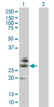 H00029965-B01 - LITAF-like protein