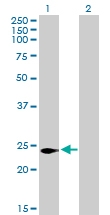 H00029965-B01P - LITAF-like protein