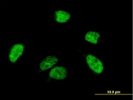 H00029974-B01P - APOBEC1 complementation factor
