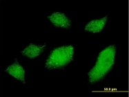 H00029979-M01 - Ubiquilin-1 (UBQLN1)