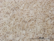 H00030062-M02 - RAX / RX