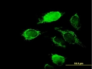 H00030819-B01P - KCNIP2